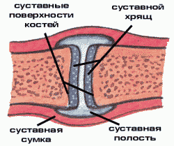 Лечение артроза коленного сустава в перми
